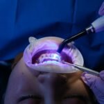 How LED Light Works in Whitening Kits and How to Enhance Its Effectiveness